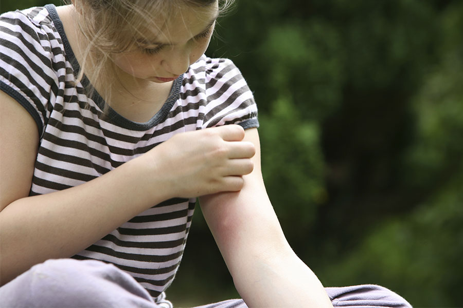 Insectenbeten voorkomen en behandelen | Consumentenbond